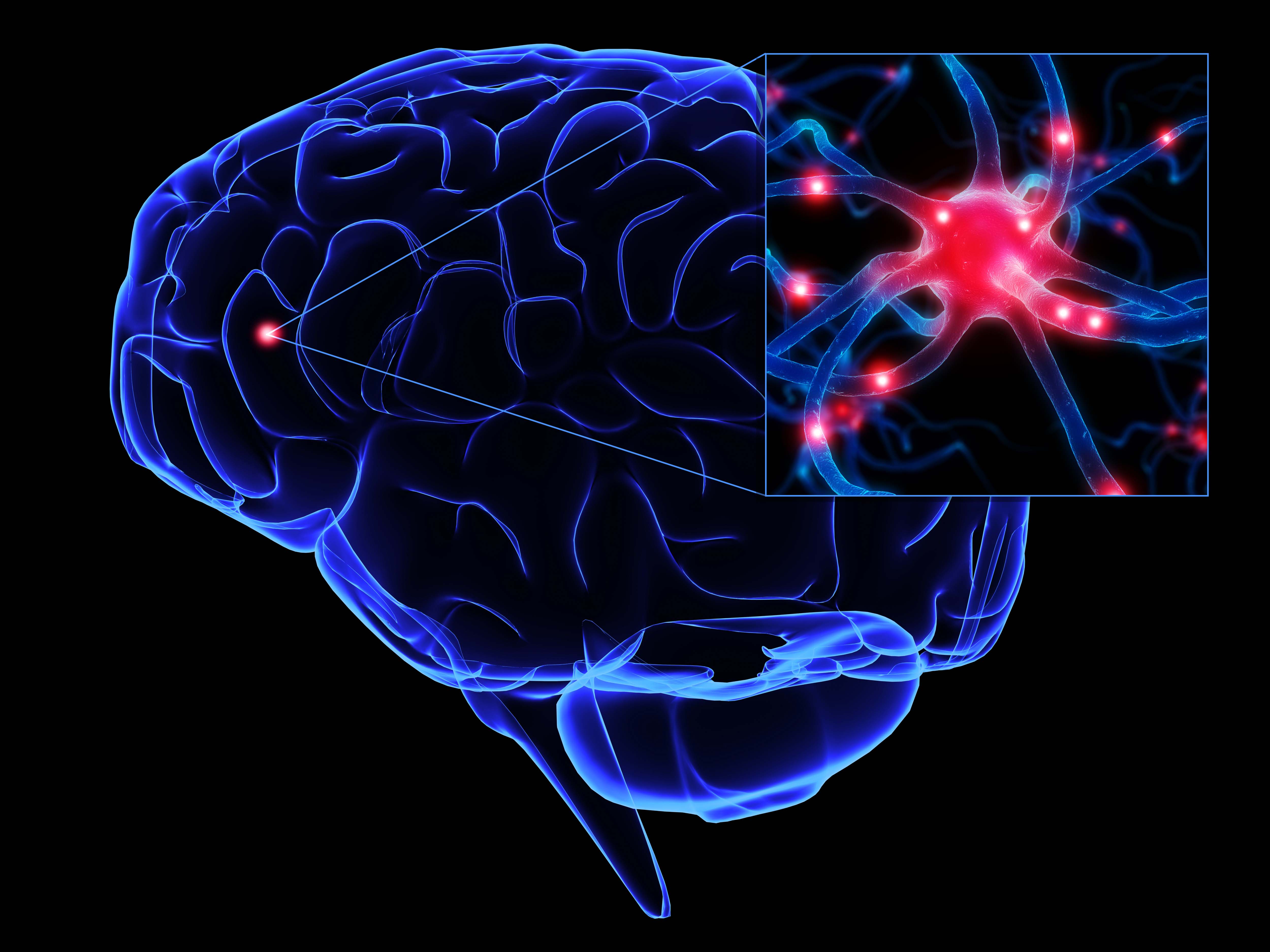 cerebro